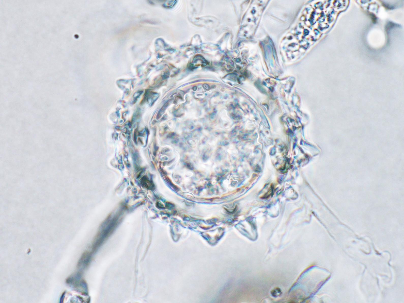 PYTHIUM ROOT ROT OF PARSLEY: NEW DISEASE IN THE USA