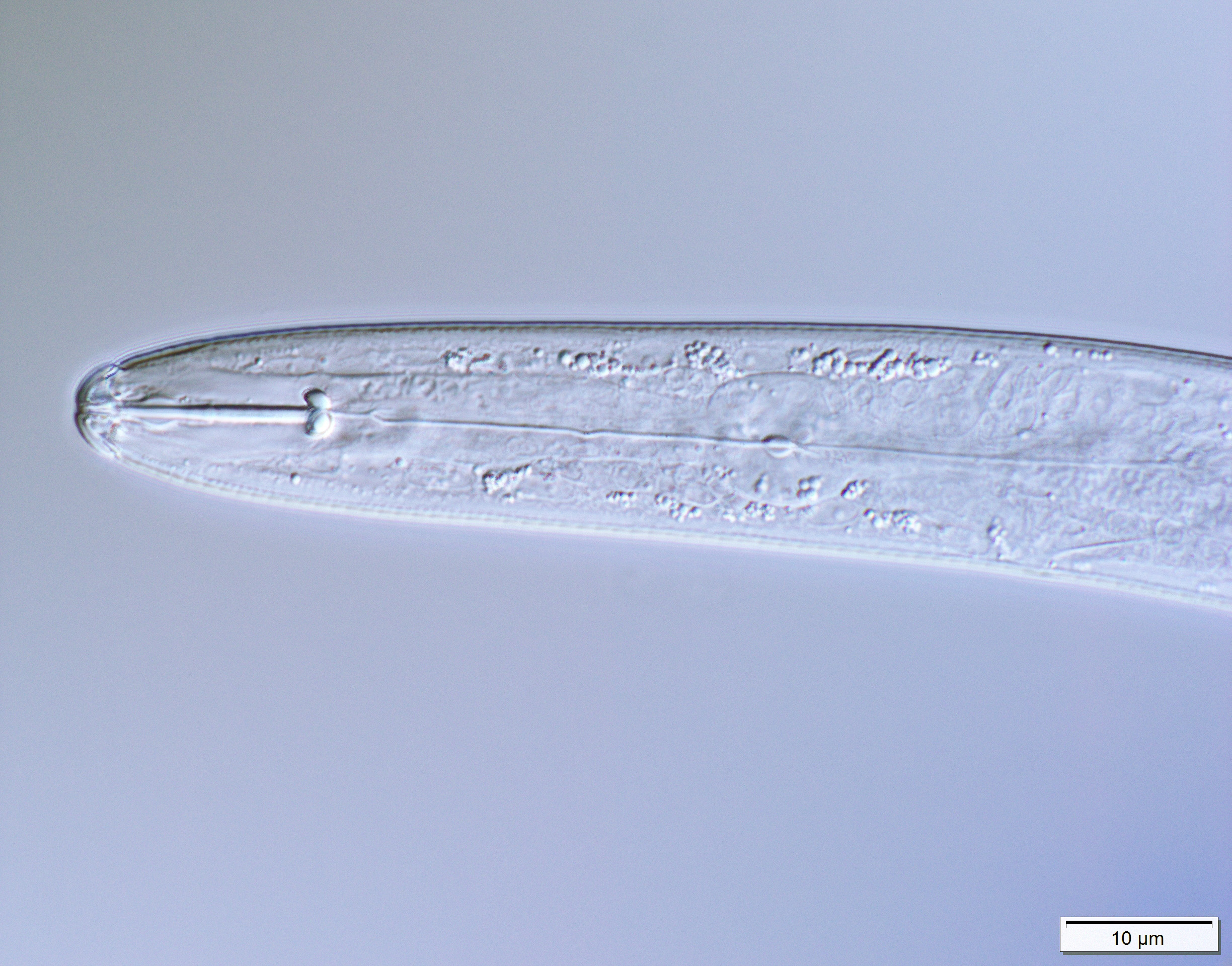 INTRODUCTION TO PLANT PARASITIC NEMATODES: 1. WHAT ARE NEMATODES?